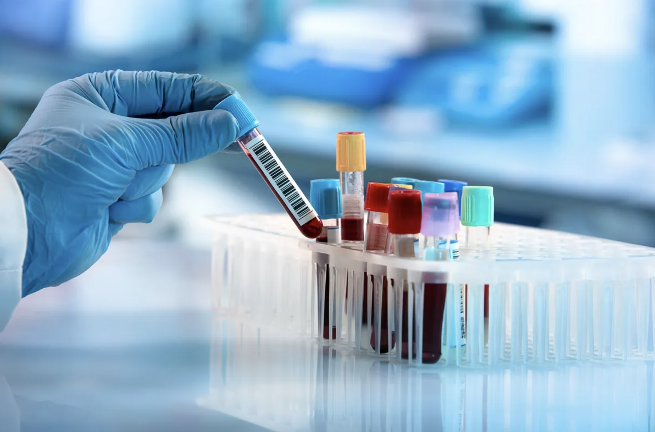 Hemofilia en México: Qué es, síntomas, diagnóstico y nuevos tratamientos